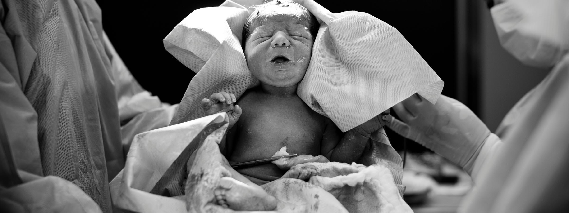 Baby held by doctor just after being born.