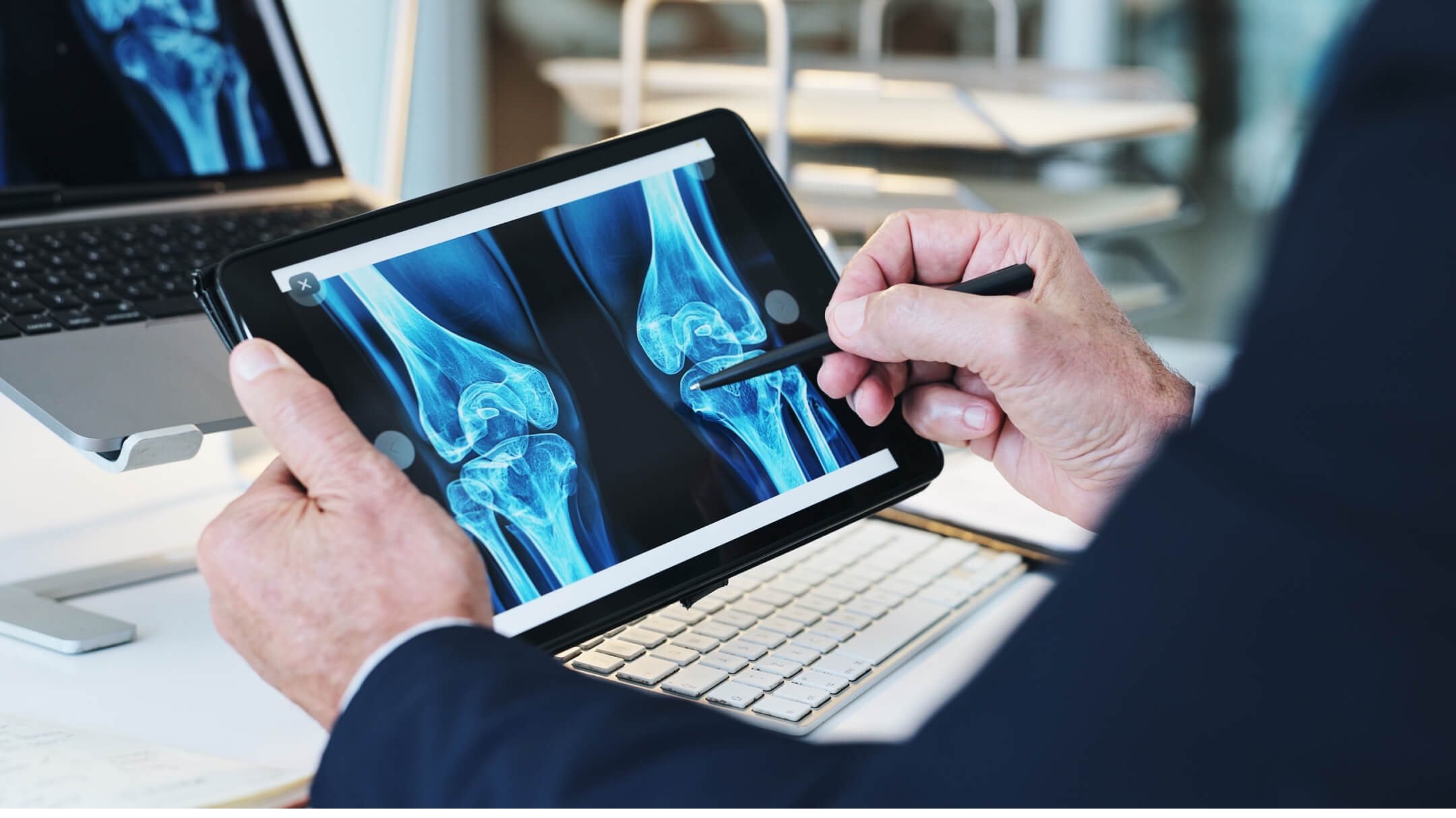  A doctor displays a knee image on a tablet, highlighting the potential of AI to advance orthopedic healthcare.