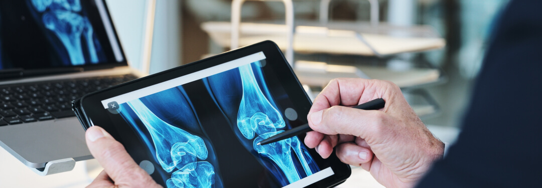 A doctor displays a knee image on a tablet, highlighting the potential of AI to advance orthopedic healthcare.