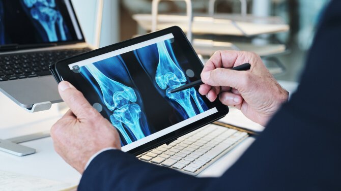  A doctor displays a knee image on a tablet, highlighting the potential of AI to advance orthopedic healthcare.
