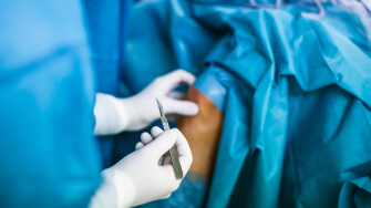 A healthcare professional in blue scrubs is holding scissors, highlighting key orthopedic surgery trends.